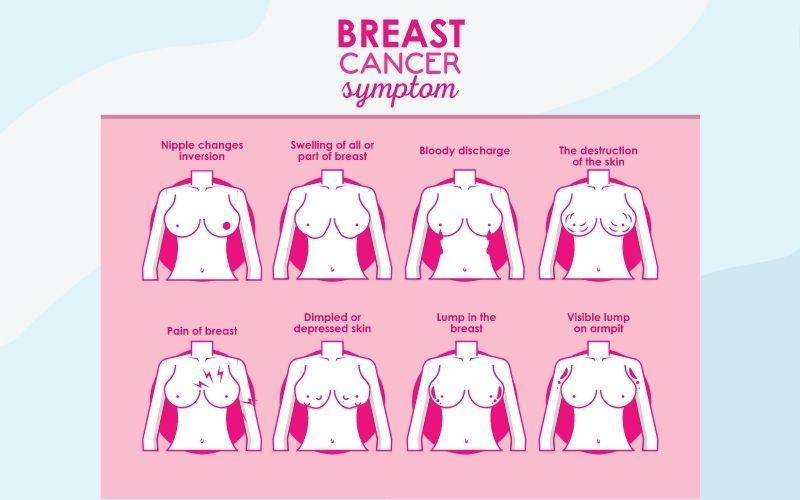 Diểu hiện của ung thư vú: Da vùng ngực thay đổi